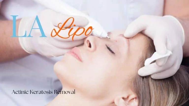 Woman receiving Actinic Keratosis Removal Treatment Huddersfield