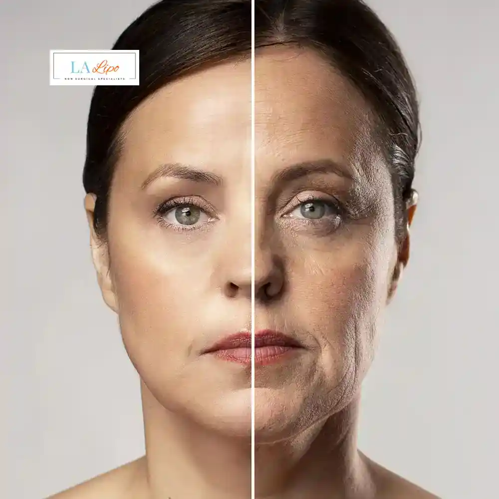 How Can You Tell If Non-Surgical Skin Tightening Is Right for You Huddersfield?