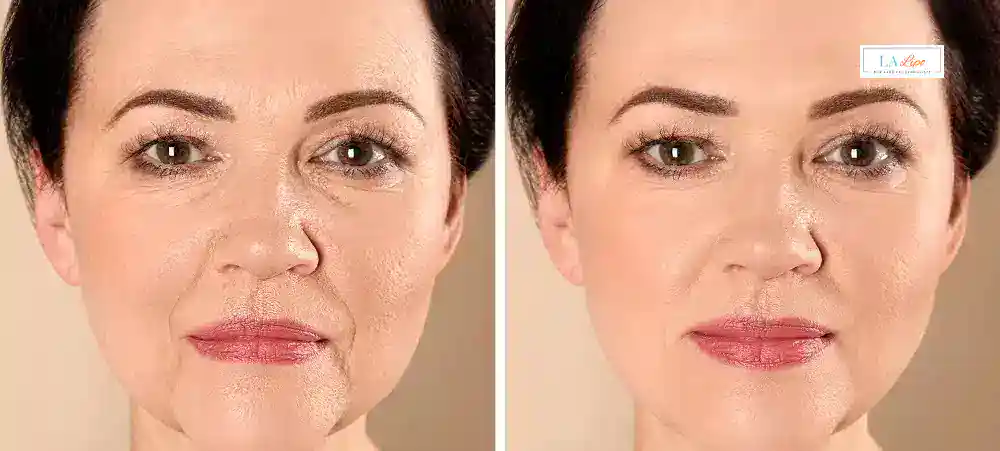 Why Aren’t My Skincare Products Making My Sagging Skin Look Firmer Huddersfield?
