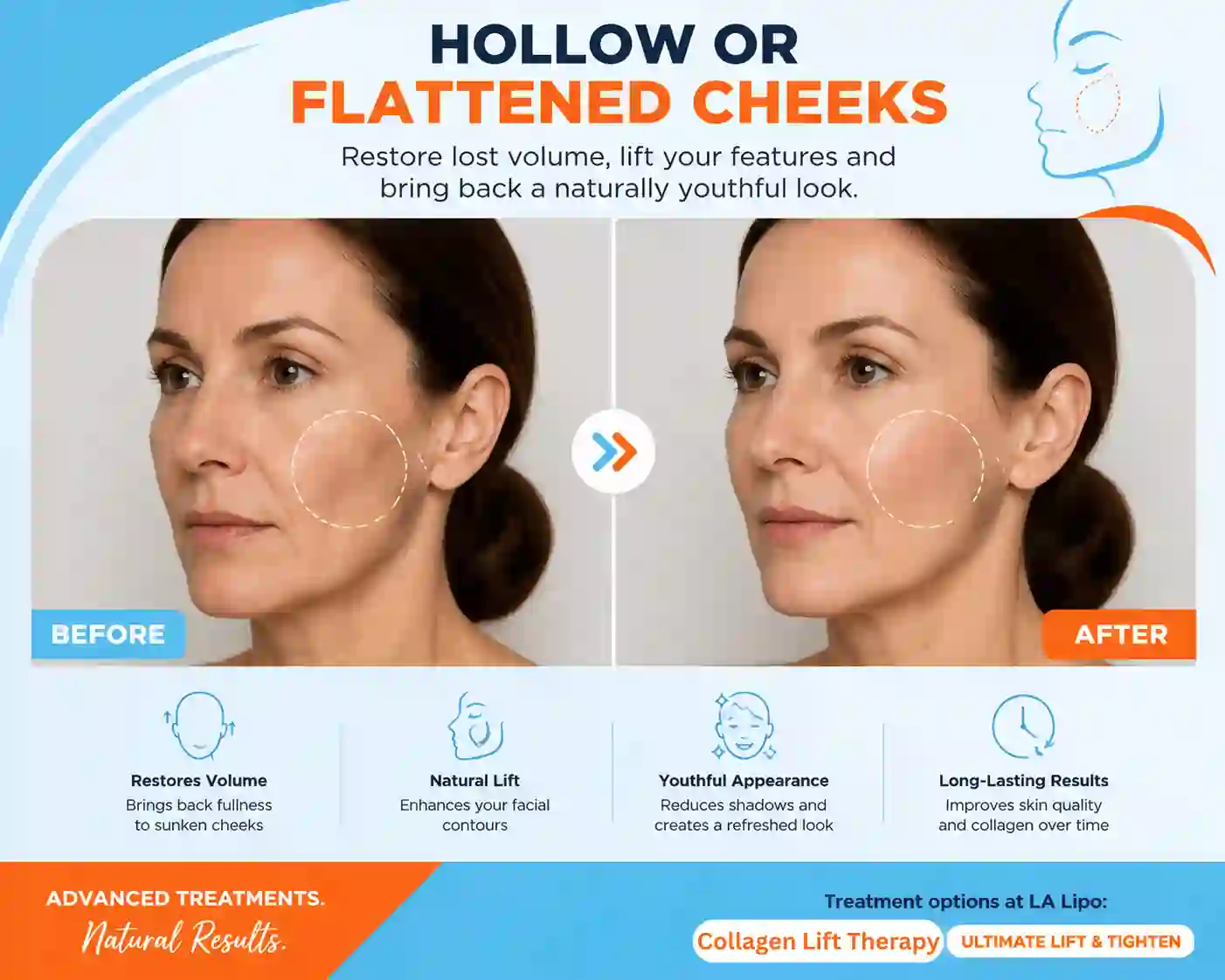 Sign #4: Hollow or Flattened Cheeks Huddersfield