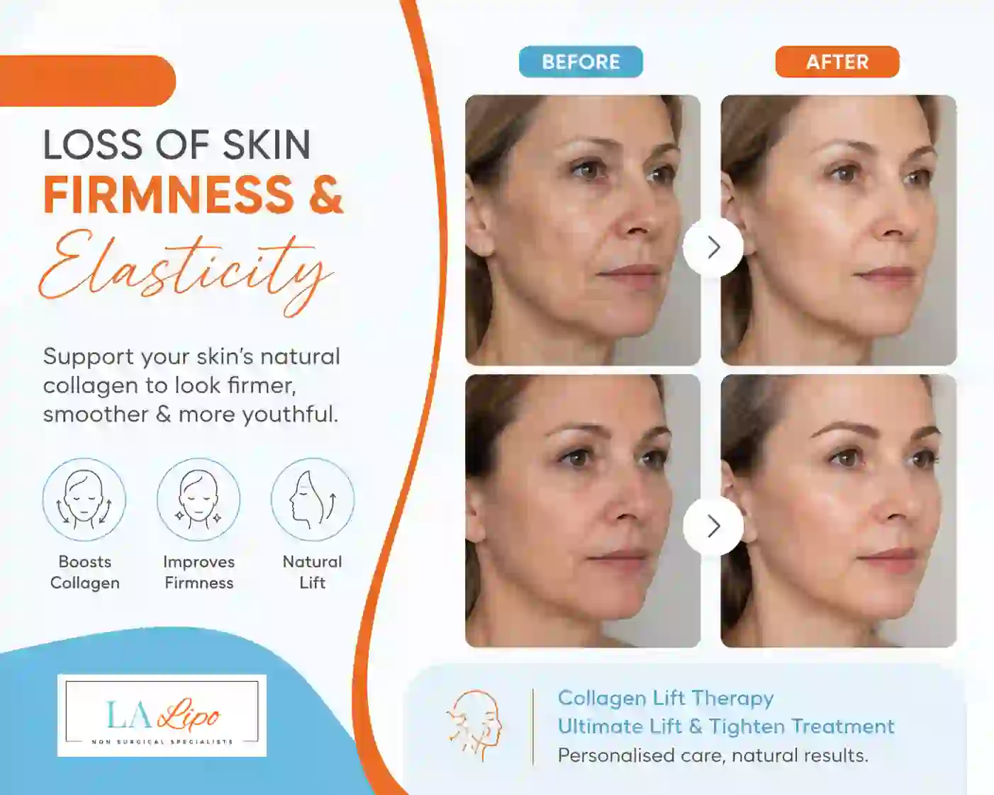 Sign #7: Loss of Skin Firmness and Elasticity Huddersfield