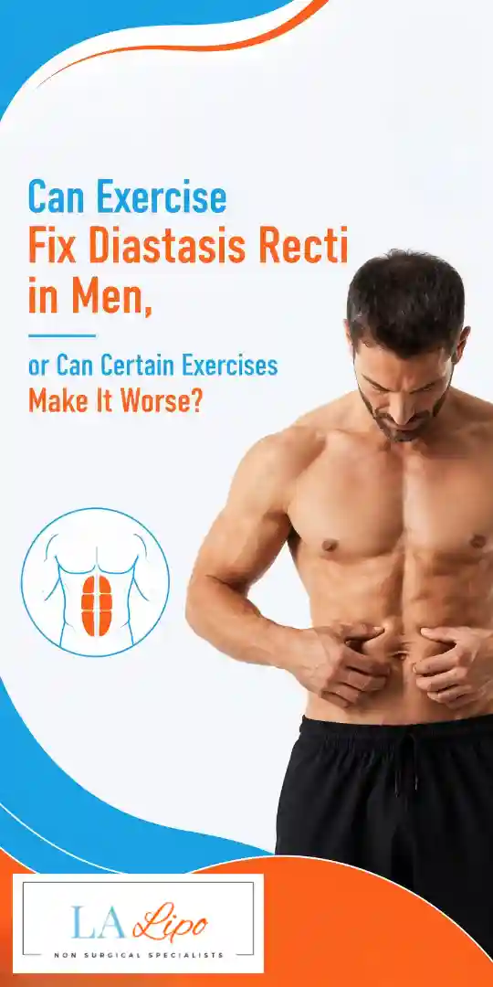 Can Exercise Fix Diastasis Recti in Men, or Can Certain Exercises Make It Worse Huddersfield?